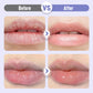 🎁LIMITED SALE - BUY 1 GET 1 FREE!!💜Plumping & Anti-Wrinkle Hydrating Lip Serum