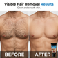 💥Buy 2 Get 1 Free🧔💨 Men's Gentle Hair Removal Cream – No Razor, No Pain, No Irritation | Smooth in 5 Mins ⏱️✨