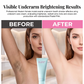 🩷Last Day-50% OFF🩷Gentle Hair Removal Cream for Men & Women – 5-10 Min, Soothing, Sensitive Skin 🌸